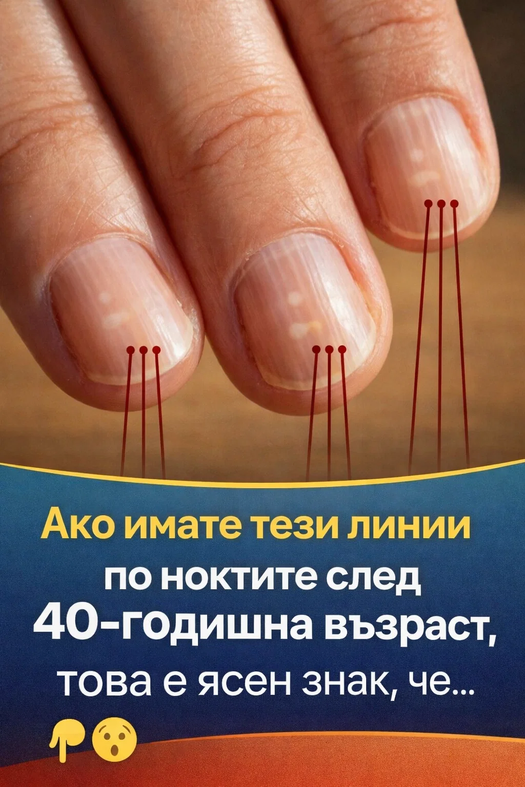 Ако забелязвате такива вертикални линии по ноктите си след 40-годишна възраст, това може да е ясен сигнал за… вижте повече