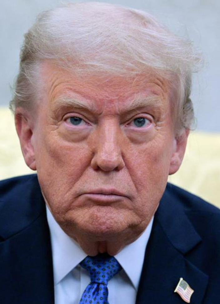 Извънредно! Диагностицираха Тръмп с болестта на…