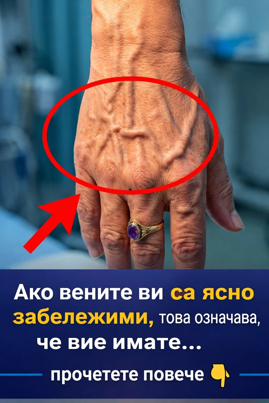 Ако вените на ръката ви са видимо изпъкнали, това е сигнал, че…