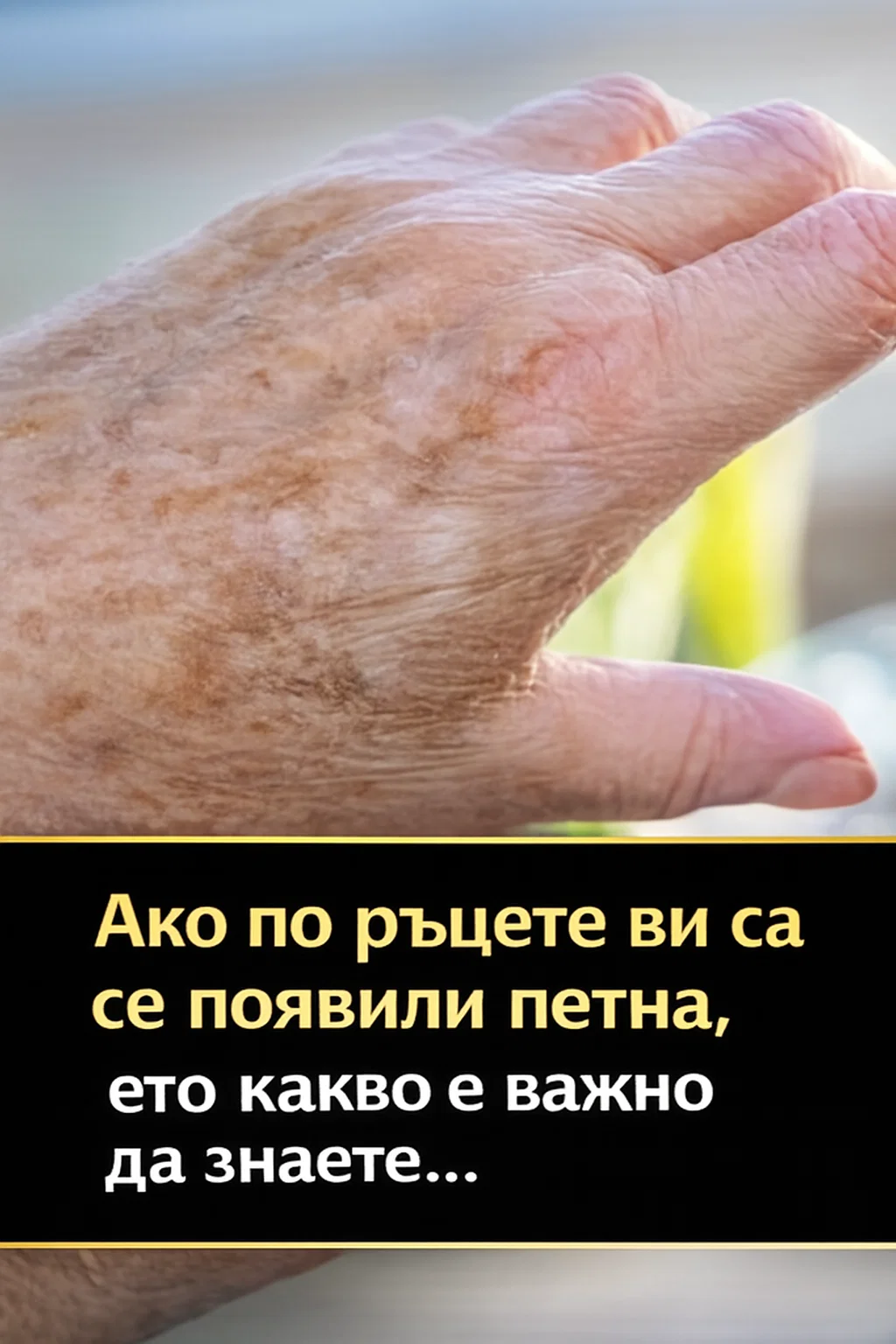 А знаете ли, че когато по ръцете се появят подобни петна, това може да е ясен сигнал, че…